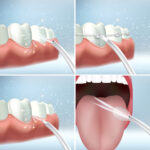 Φορητό Επαναφορτιζόμενο Οδοντικό Αρδευτικό Denter InnovaGoods