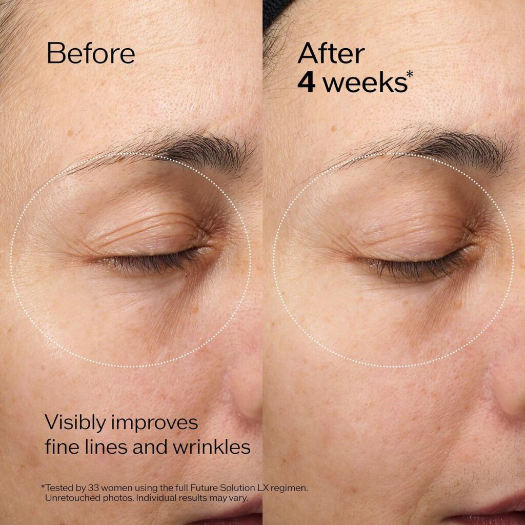 Προστατευτικό χειλιών Shiseido FUTURE SOLUTION LX