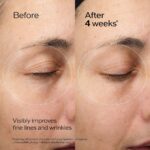 Προστατευτικό χειλιών Shiseido FUTURE SOLUTION LX